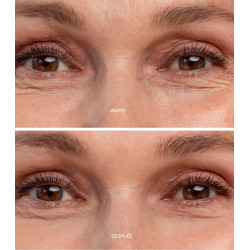Contorno de Ojos hidratante anti-edad para evitar las bolsas y ojeras