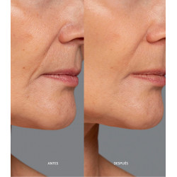 Contorno de Labios Hidratante Anti-Arrugas con Efecto Flash